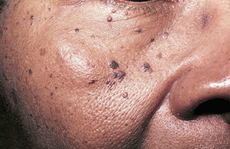 skin-condition-img