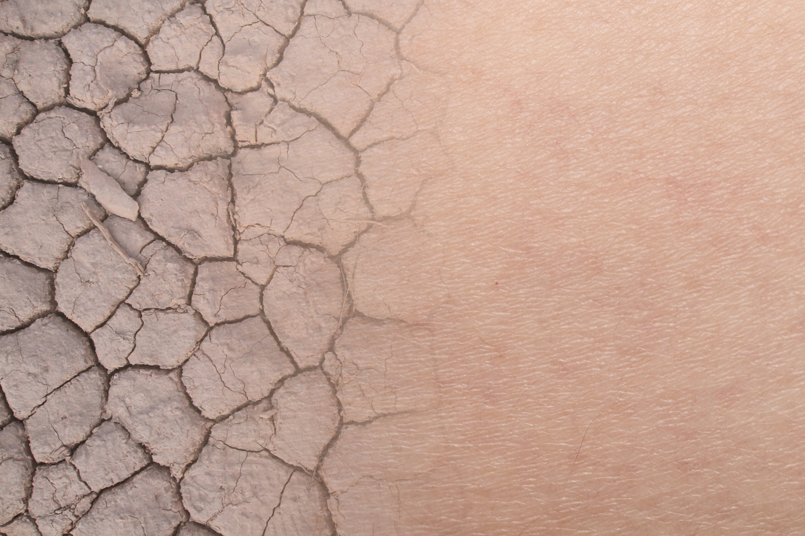nail-fungus-img